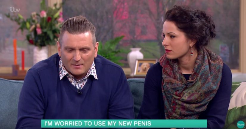 Man With Bionic Penis Photo