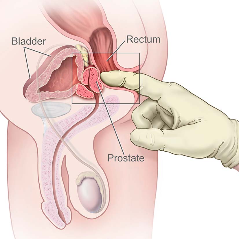 The location of the prostate